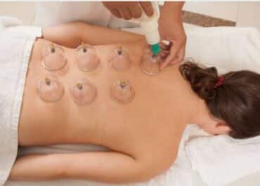 Exploring Cupping Therapy: When and How It Can Be an Effective Treatment